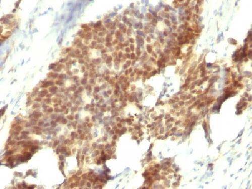 ER-beta-1 (Estrogen Receptor beta-1) Antibody