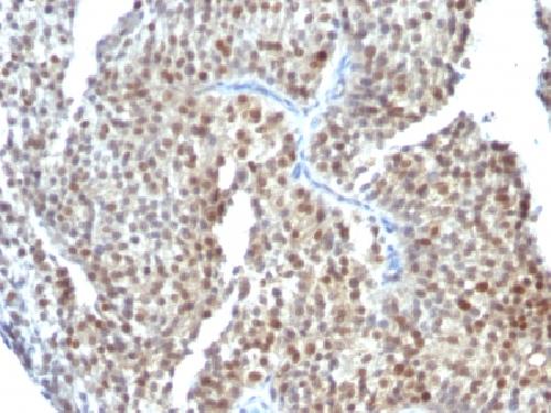 ER-beta-1 (Estrogen Receptor beta-1) Antibody