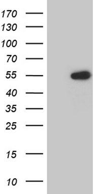 Estrogen Related Receptor alpha Antibody