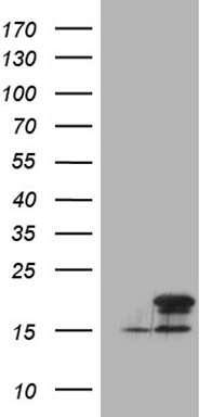 Estrogen Related Receptor alpha Antibody