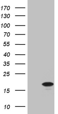 Estrogen Related Receptor alpha Antibody
