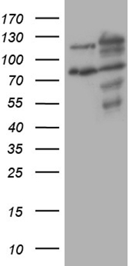 Estrogen Related Receptor alpha Antibody