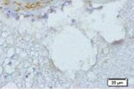 Estrogen receptor beta Rabbit pAb
