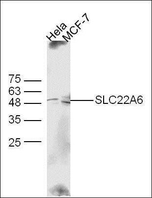 Estrogen receptor beta Rabbit pAb