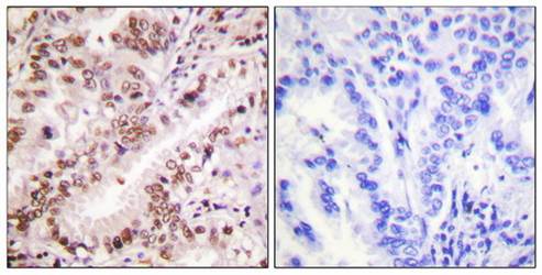 Estrogen Receptor-alpha (phospho-Tyr537) antibody