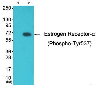 Estrogen Receptor-alpha (phospho-Tyr537) antibody