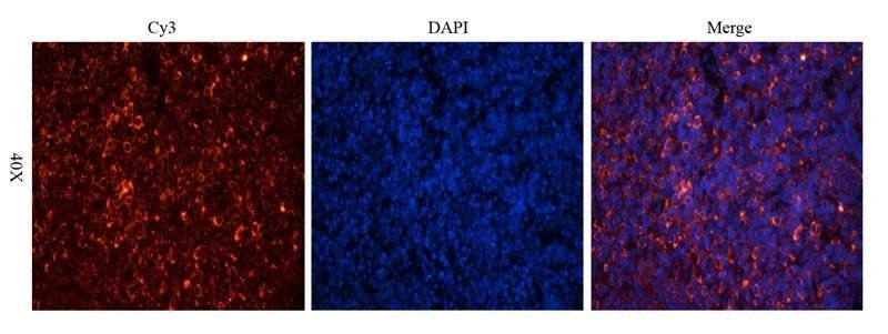 Estrogen Receptor beta 2 antibody