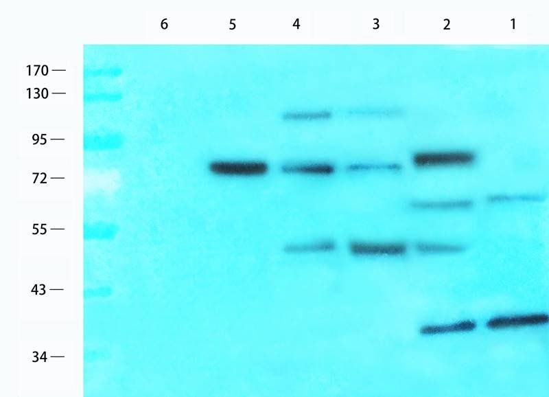 Estrogen Receptor beta 2 antibody