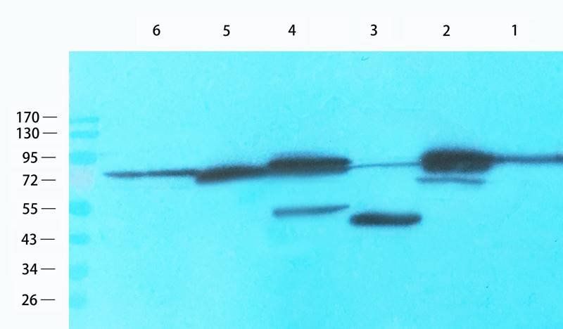 Estrogen Receptor beta 2 antibody