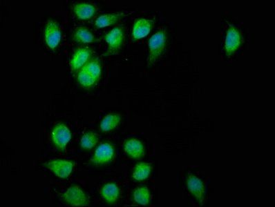 ESYT2 antibody