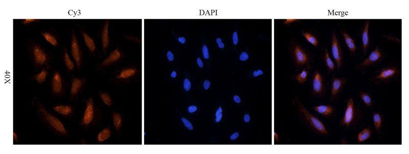 Endothelin 1 antibody