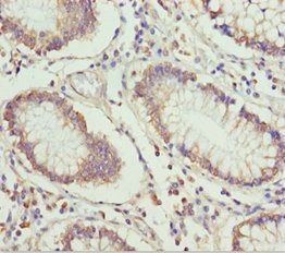 ETFA Antibody