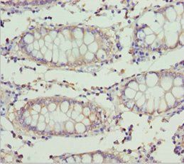 ETFA Antibody