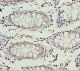 ETFA antibody