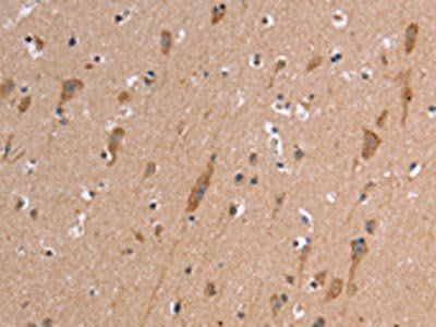ETFB Antibody