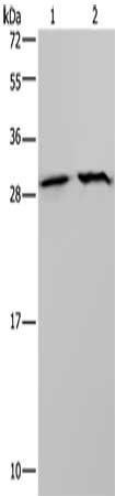 ETFB Antibody
