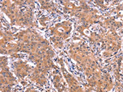 ETFB Antibody