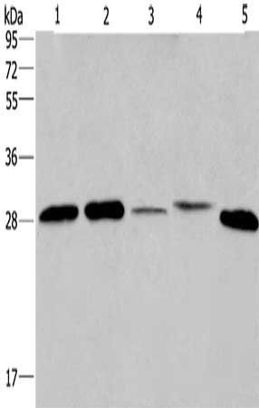 ETFB antibody