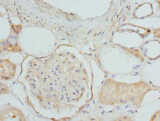ETFDH Antibody