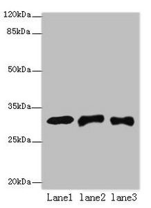 ETHE1 Antibody