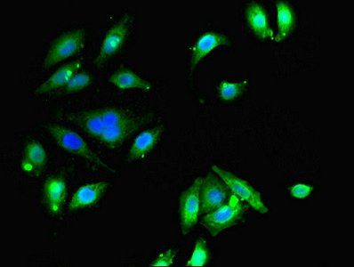 ETNK1 Antibody