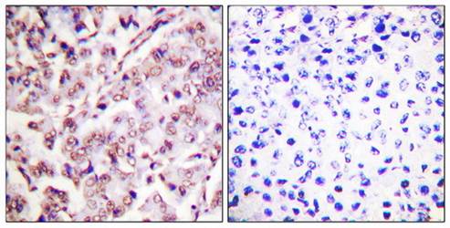 ETS1 (Phospho-Thr38) Antibody
