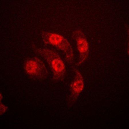 ETS1 (phospho-T38) antibody