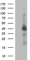 ETS2 Antibody