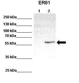 ETV1 antibody