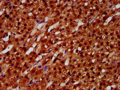 ETV5 Antibody