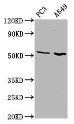 ETV5 Antibody