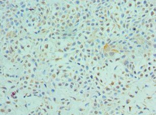 ETV6 Antibody