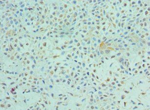 ETV6 antibody