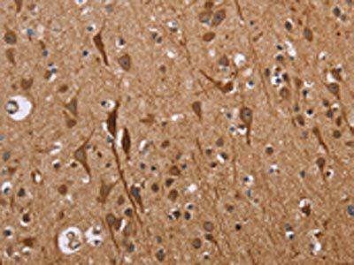 ETV7 Antibody