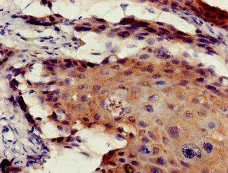 ETV7 Antibody