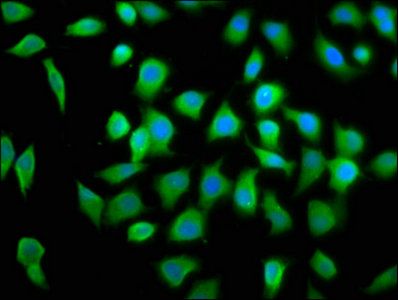 Eukaryotic initiation factor 4A-II antibody