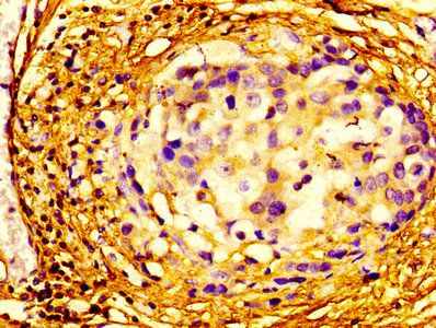 Eukaryotic initiation factor 4A-II antibody