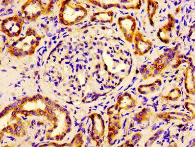 Eukaryotic initiation factor 4A-II antibody