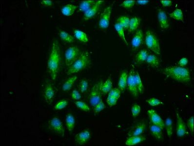 Eukaryotic translation initiation factor 3 subunit I antibody