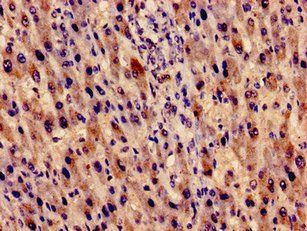 EVC Antibody