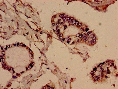 EVC Antibody