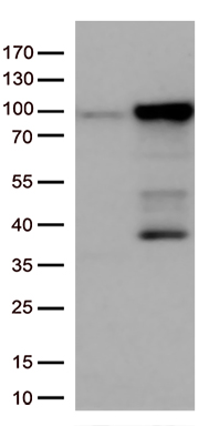 EWSR1 Antibody