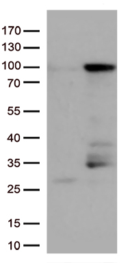 EWSR1 Antibody