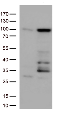 EWSR1 Antibody