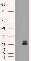 EWSR1 Antibody