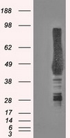EWSR1 Antibody