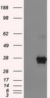 EWSR1 Antibody