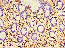 EWSR1 Antibody