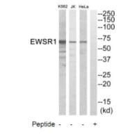 EWSR1 Antibody