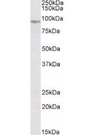 Goat anti-EWS / EWSR1 Antibody